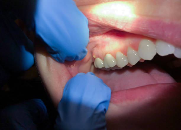 Best Emergency Treatment for Jaw Pain or Injury in Annapolis Neck, MD